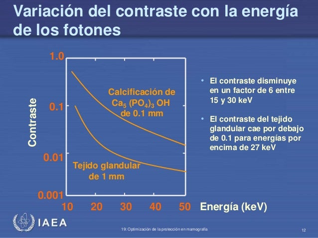 Que es la energia de fotones en mamografia 47 Que es la energia de fotones en mamografia 59